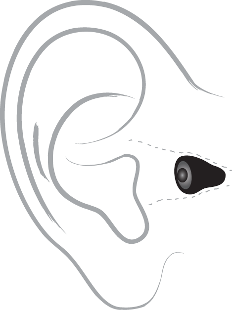 Cumberland Invisible hearing aid diagram